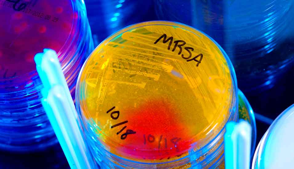 Petrischalen mit Kulturen des Antiobiotika-resistenten Keims MRSA