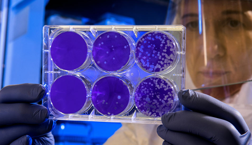 Es sind sechs Petrischalen zu sehen mit Bakterienstämmen, die von einer Forscherin im weißen Schutzanzug hochgehalten werden. 