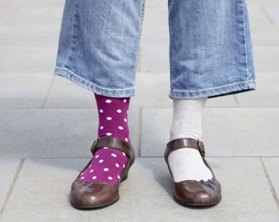 Füße einer Frau mit zwei unterschiedlichen Socken