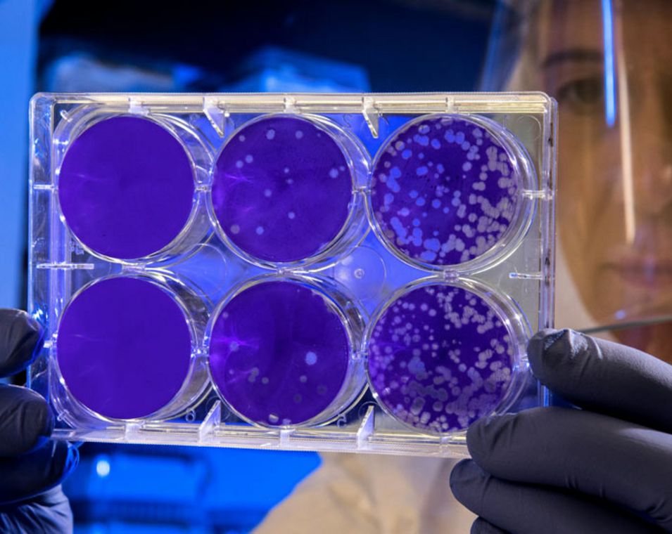Es sind sechs Petrischalen zu sehen mit Bakterienstämmen, die von einer Forscherin im weißen Schutzanzug hochgehalten werden. 