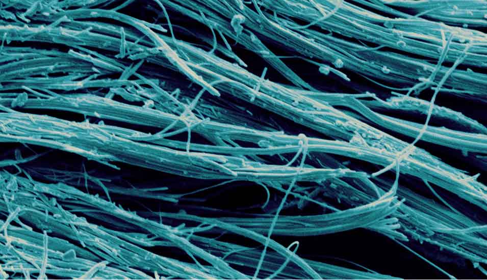 Das Foto zeigt Asbestfasern unter dem Mikroskop