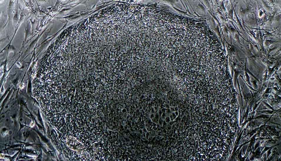 Lichtmikroskopische Aufnahme von induzierten, reprogrammierten pluripotente Stammzellen des Menschen