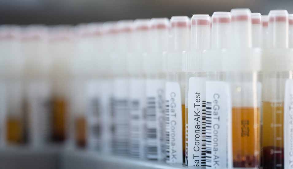 Blutentnahmeröhrchen mit Blutproben für einen Corona-Antikörper-Test 