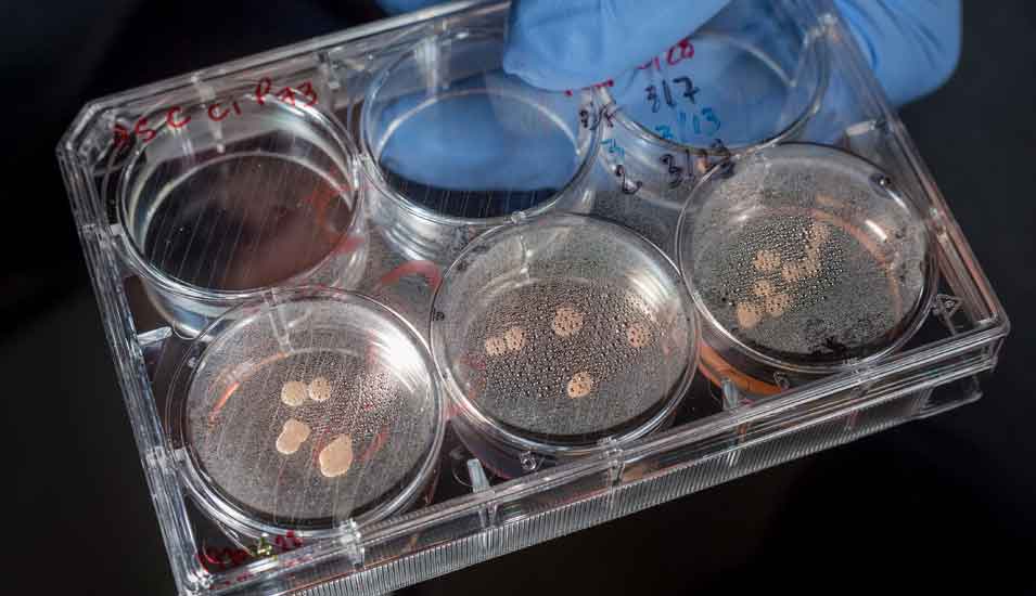 "Mini-Gehirne": Organoide aus Stammzellen in einem Laborgefäß für Zellkulturen