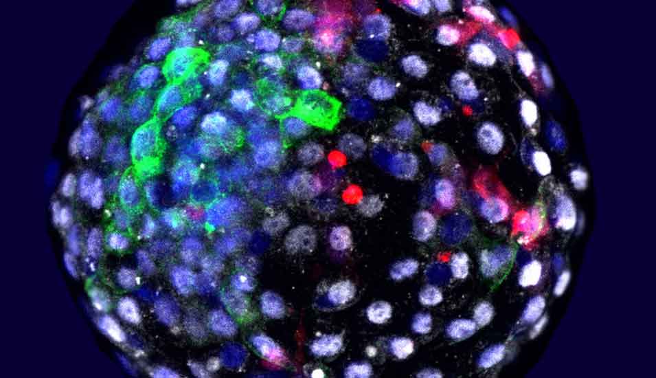 Affenemybro-Blastozyste mit farblich markierten Zelltypen