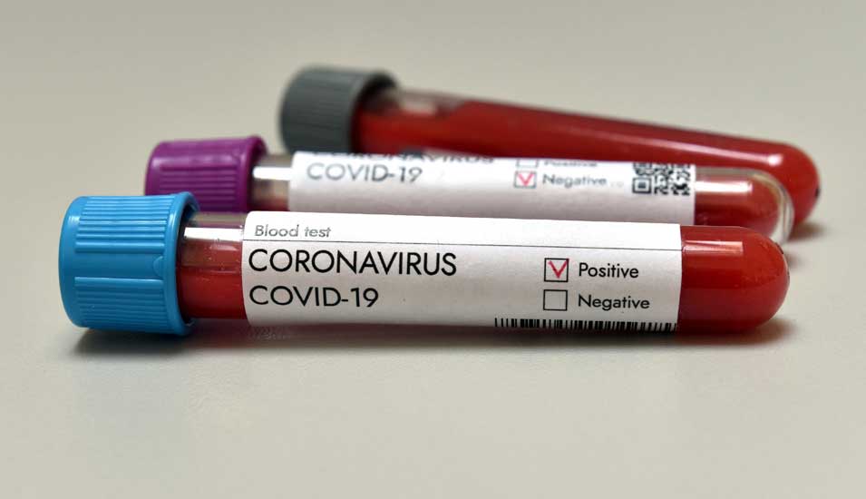 Blutproben mit Corona-Viren