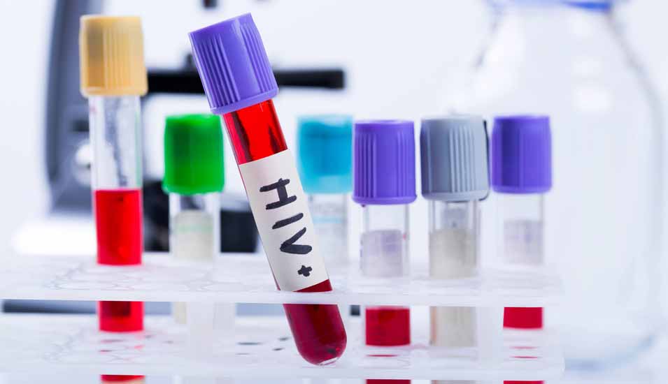 Röhrchen mit Blutprobe mit Aufschrift "HIV +"