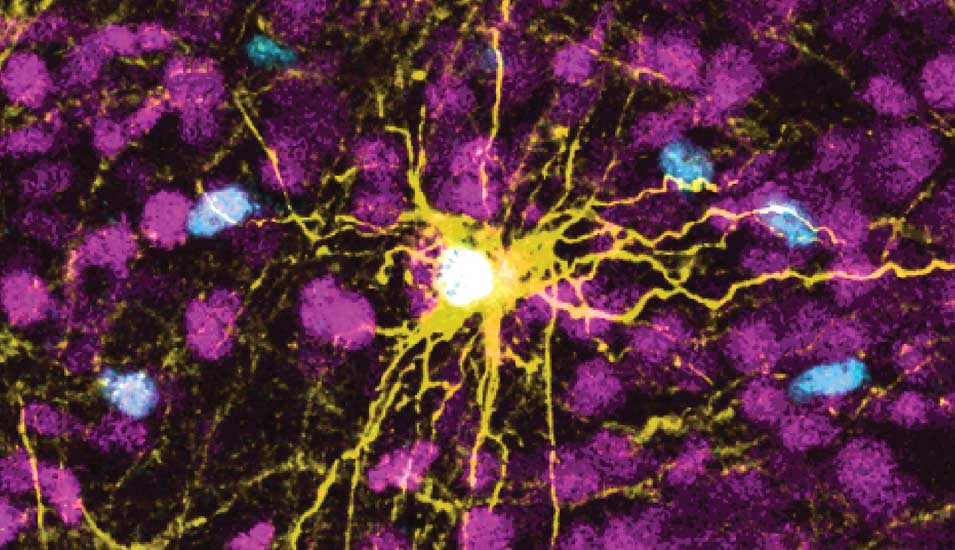 Diese Mikroskopaufnahme des Forscherteams zeigt menschliche Nervenzellen – eine Astrozytenzelle (gelb) und Gliazellen (blau)– im Gehirn einer Ratte.