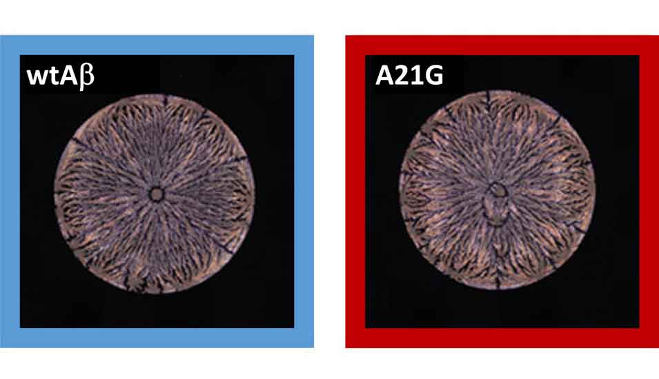 Zwei Abbildungen von Trocknungsmustern von Peptid-Lösungen, links: Amyloid-beta-(Aβ42)-Peptid, rechts: Mutation