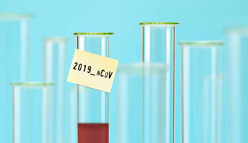 Reagenzglas mit Zettel und der Aufschrift 2019-nCoV