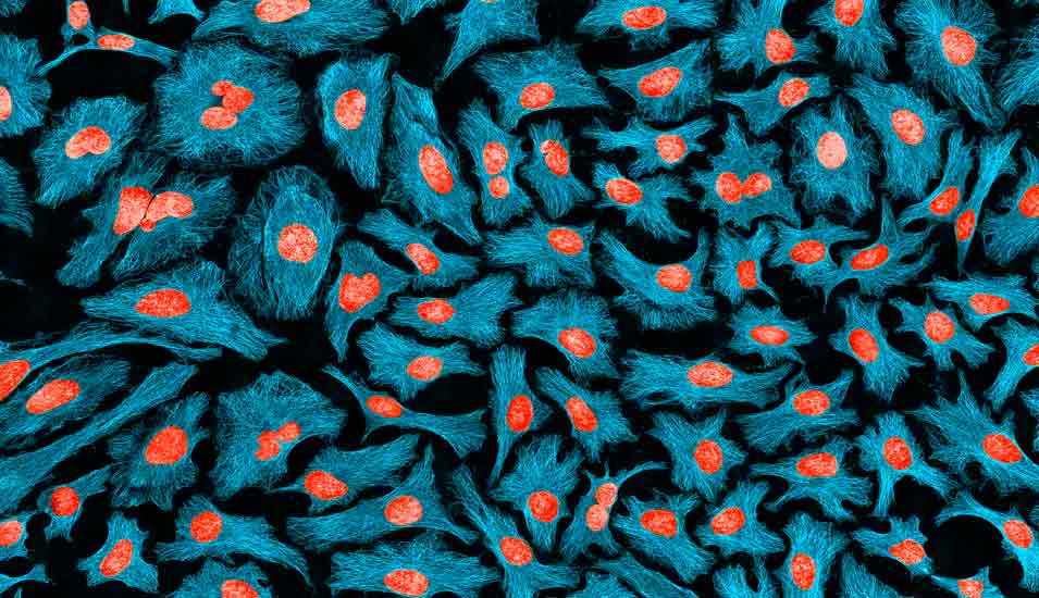 Mikroskopaufnahme von HeLa-Zellen mit blau angefärbtem Cytoskelett und rot angefärbter DNA im Zellkern.