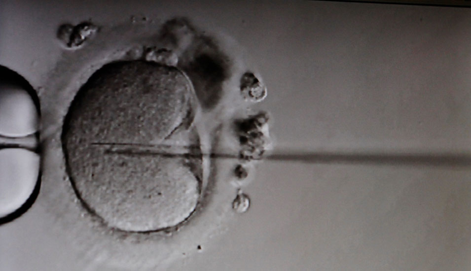 Mikroskopische Aufnahme einer In-vitro-Fertilisation (IVF).