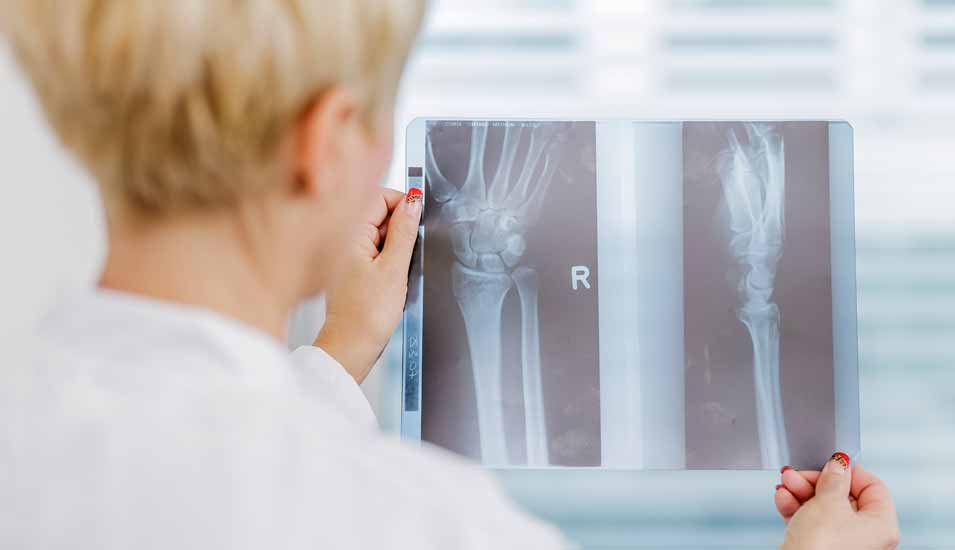 Ärztin betrachtet zwei Röntgenbilder von einer Hand aus zwei Perspektiven