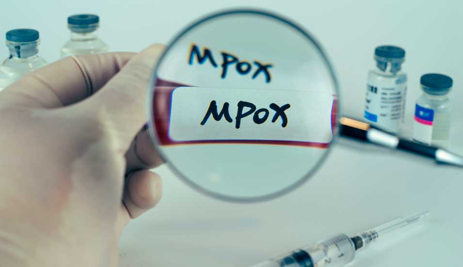 Blutprobe mit der Aufschrift Mpox sowie Medikamente und Spritzen